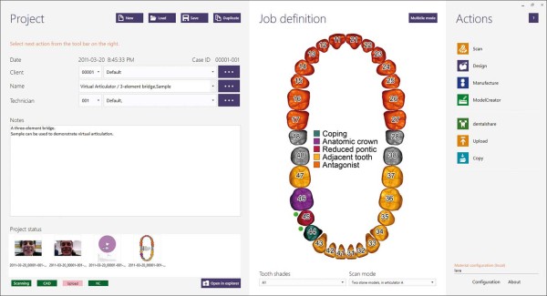 Exocad Basic Software (Exocad DentalCAD)