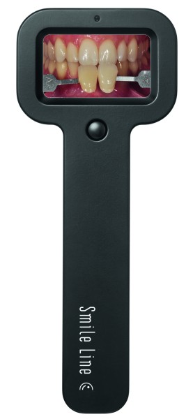 Smile Lite