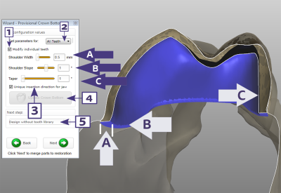 Exocad Basic Software (Exocad DentalCAD)