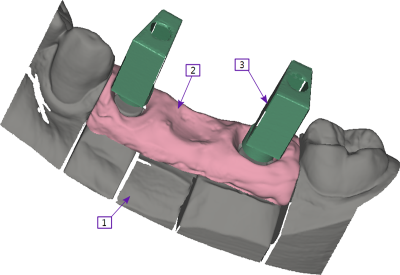 Exocad Basic Software (Exocad DentalCAD)